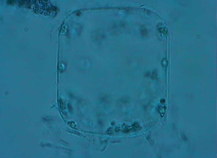 Dictyocha speculum